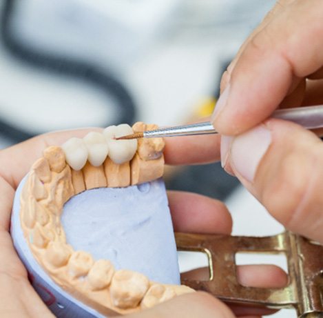 Ceramist crafting a dental bridge on a model of an arch of teeth